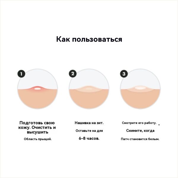Звезда Форма Мастер Caja Hydro Красочные Прыщ Пластырь Акне Звезда Box - 图片 6